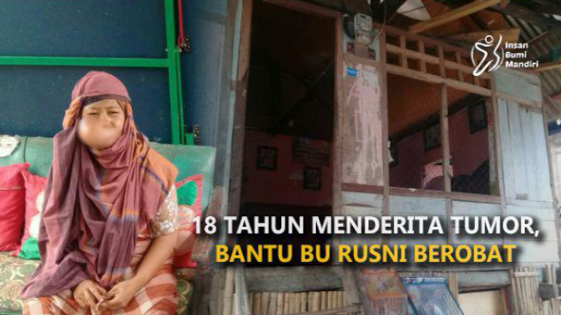 18 TAHUN MENDERITA TUMOR, BANTU BU RUSNI BEROBAT