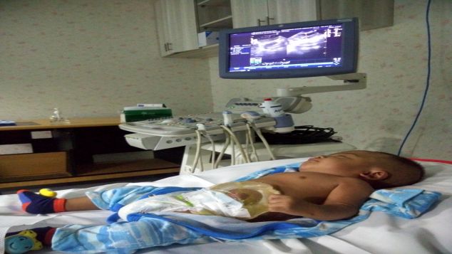 Bantu Muhammad terbebas dari atresia ani