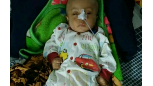 BANTU BABY RIZKY MENYEMBUHKAN RADANG OTAKNYA