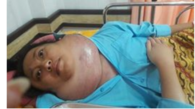 Ayo Kita Bantu Eni Hartatik 20th