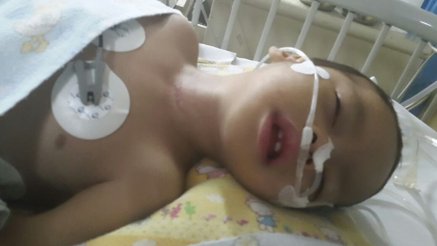 Sembuhkan Samuel, Pasien CEREBRAL PALSY & EPILEPSI