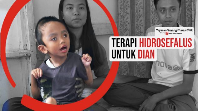 Terapi Hidrosefalus dan Cerebral Palsy untuk Dian
