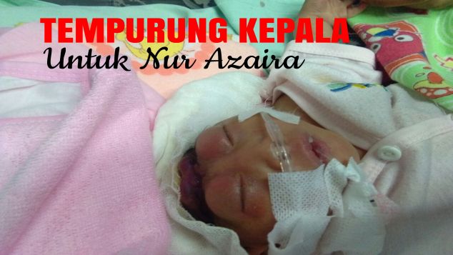 Tempurung Kepala untuk Adik Nur