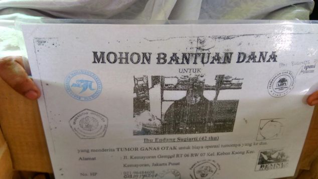 Biaya operasi tumor ganas otak bu endang sugiarti
