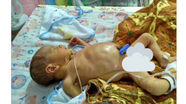 Bantu Bayi Fatur Melawan Sakitnya