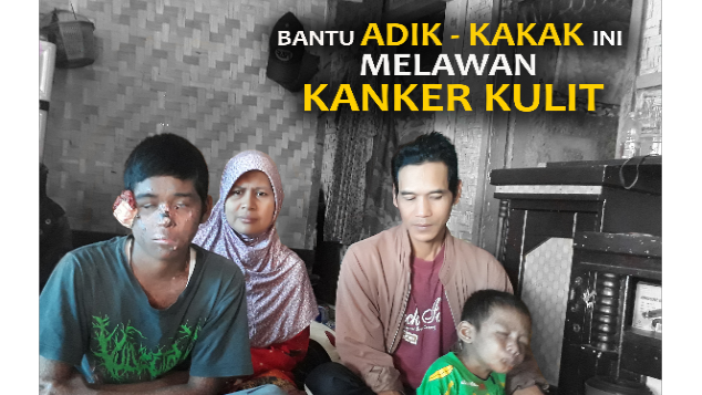 Bantu Tedi dan Adiknya Melawan Kanker Kulit