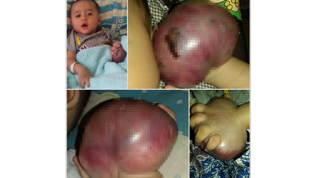 Bantu selamatkan adek Vino