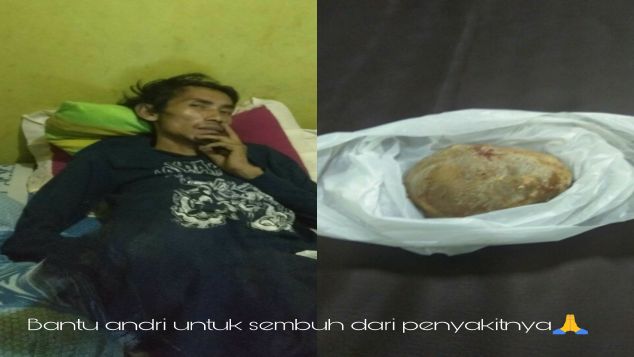 Bantu andri sembuh dari batu ginjal dan tumor