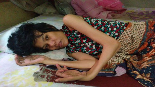 Bantu ibu Rejeki, Ibu Penderita Lumpuh Total.