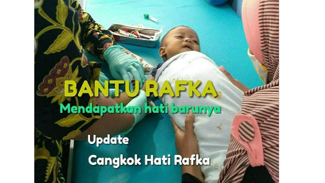 Bantu Rafka Kalandra Dirja Cangkok Hati
