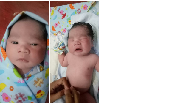 Bantu operasi bayi Nurhasan, lahir tanpa anus