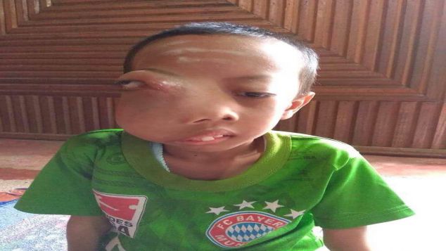 Bantu egi untuk melihat kembali