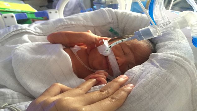 Bantu Mario Sembuh Dari NICU