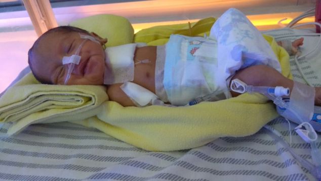Bantu baby adzhani menutup lubang di lambung nya
