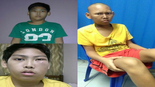 Keluarga menggalang dana untuk kanker nasofaring