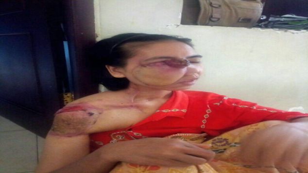 Pengobatan Kanker Ibu Nur