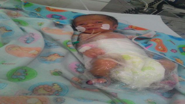 Bantu Ibu dan Bayi Aisyah yang Lahir Prematur