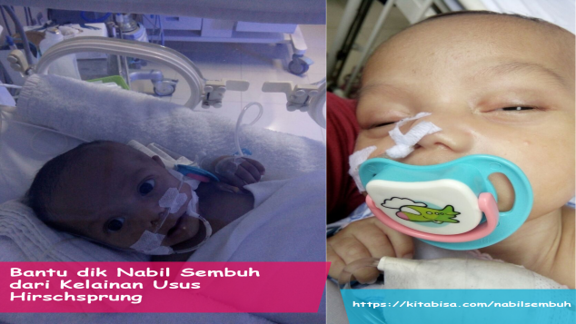 Bantu Nabil sembuh dari kelainan usus Hirschsprung