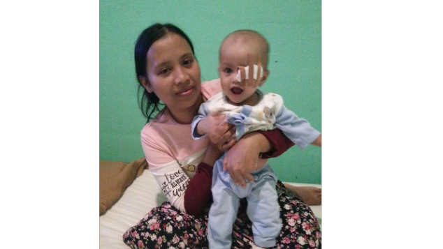 Syahna (8 Bulan) Terancam Kehilangan Kedua Matanya