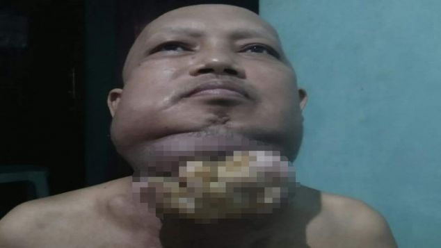 yuk kita bantu pak Dedi melawan kanker getah benin