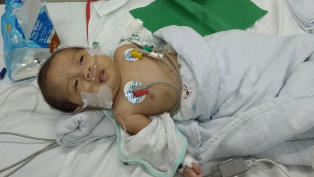 Biaya Operasi Atresia Exsofagus dan Atresia Ani