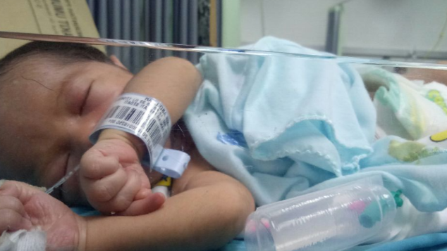 Bantu Hanif anak istimewa tanpa anus