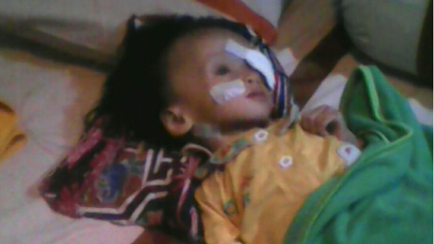 Bantu Angel sembuh dari Retinoblastoma