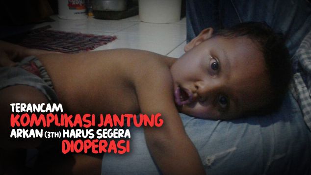Arkan Terancam Kritis karena Kebocoran Jantung