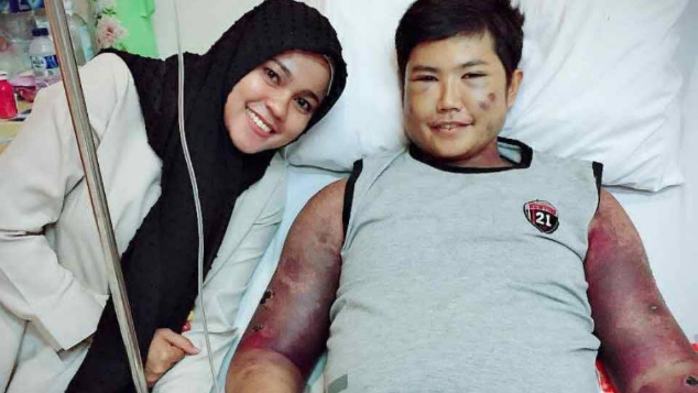 Bantu Badawi melawan Autoimun dan Lupus