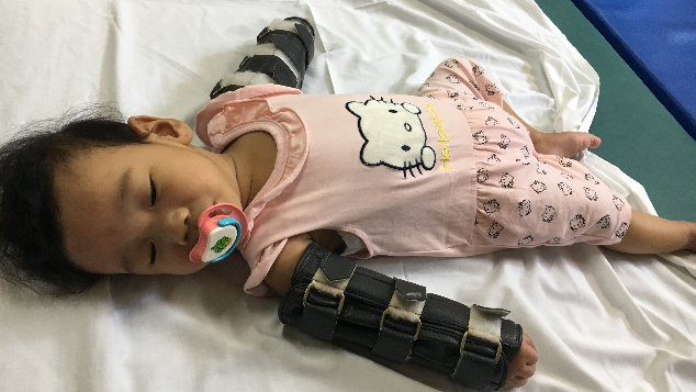 Bantu si cantik Naia atasi Cerebral palsy
