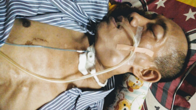 Bantu Hasan Lawan Tumor dan Kelenjar Getah Bening