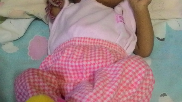Bantu anak sakit atresia bilier