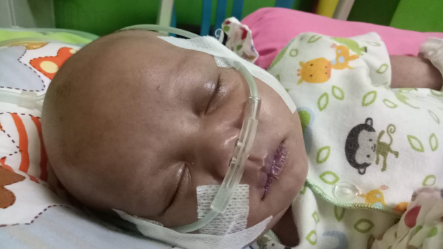 Bantu Fely Operasi Jantung