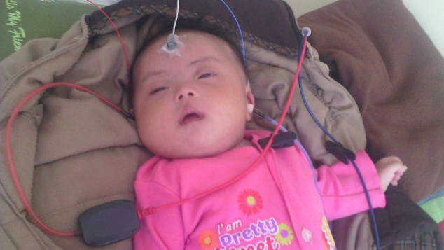 Bantu Nafisa Sembuh dari Rubella dan Down Syndrome