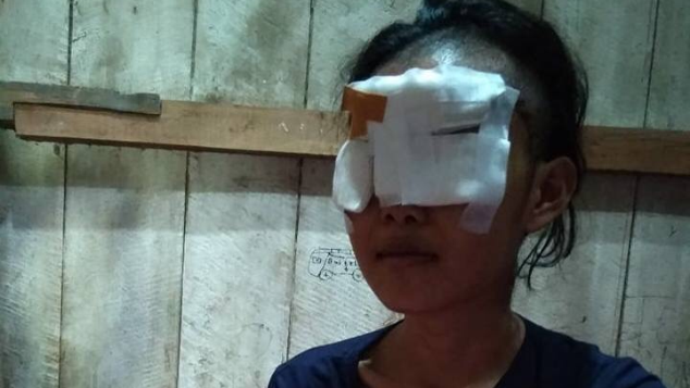 Bantu Evit sembuh dari sakit akibat kecelakaan