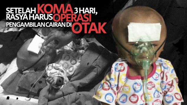 Koma 3 Hari, Rasya Ingin Sembuh dari Hidrosefalus