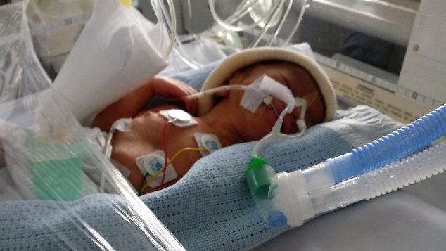 Bantu Bayi Fathir dalam Perawatan NICU