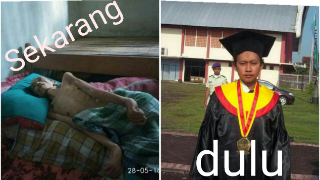 Bantu Wahab Melawan Kanker
