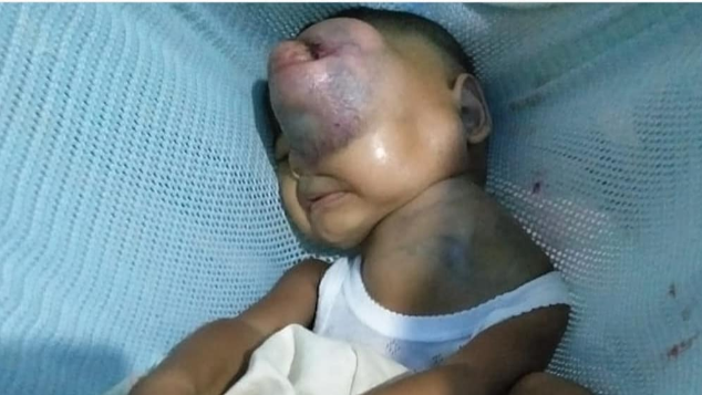 Bantu Si Kecil Firja Melawan Tumor