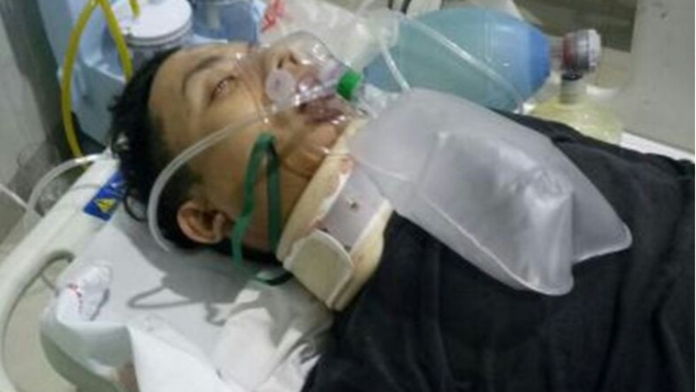 Bantu Iqbal Korban Tabrak Lari Pendarahan Otak