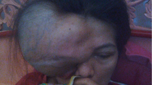 Mari Bantu Ibu Pujiati Sembuh dari Penyakitnya