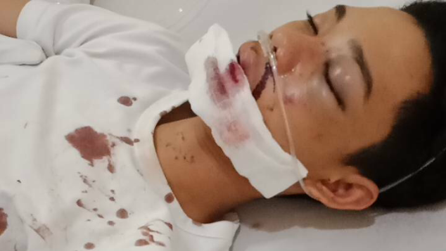 Bantu Izza untuk Operasi