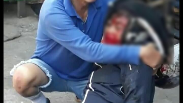 Bantu Eva Operasi karena Kecelakaan