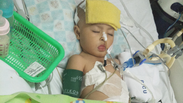 Bantu Shakila melawan meningitis TB bantu