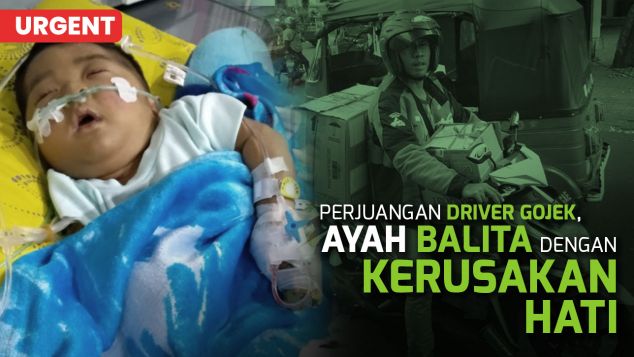 Bantu Maulana, Balita Pejuang Atresia Bilier