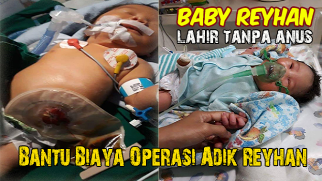 BANTU BIAYA OPERASI REYHAN
