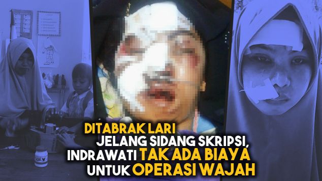 Jelang Sidang Skripsi, Indrawati Ditabrak Lari