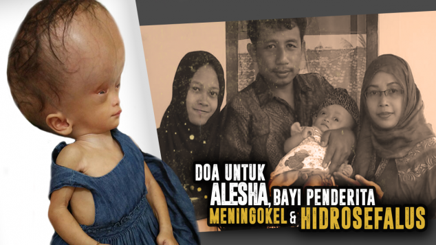 Bantu Alesha Menang Lawan Hidrosefalus