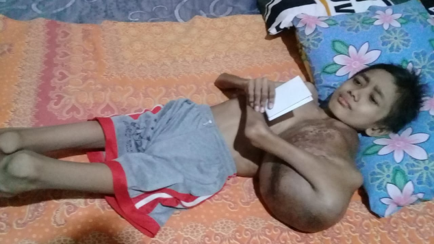 Bantu Dek Fathur melawan Kanker