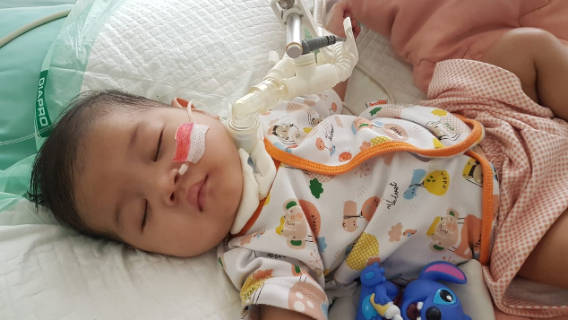 Al Fatih berjuang melawan Jeune Syndrome